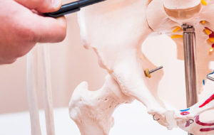 Closeup on medical doctor man pointing on hernia in the pelvis of human skeleton anatomical model. Selective focus