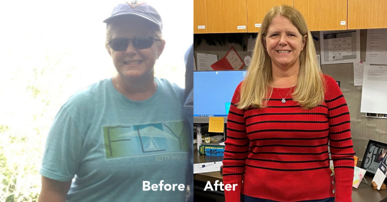 Jeanne’s Weight Loss Journey